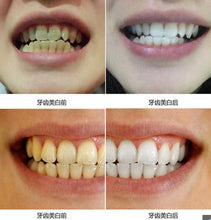 Load image into Gallery viewer, 10ml Teeth Whitening Water Oral Hygiene Cleaning Teeth Care Tooth Cleaning Whitening Water Clareamento Dental Odontologia