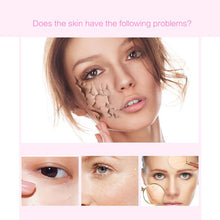 Load image into Gallery viewer, 1pcs Plant Extract Face Scrub Exfoliating Gel Brightening Skin Care Face Scrub Removal Peeling Cream Acne Treatment Skin Care